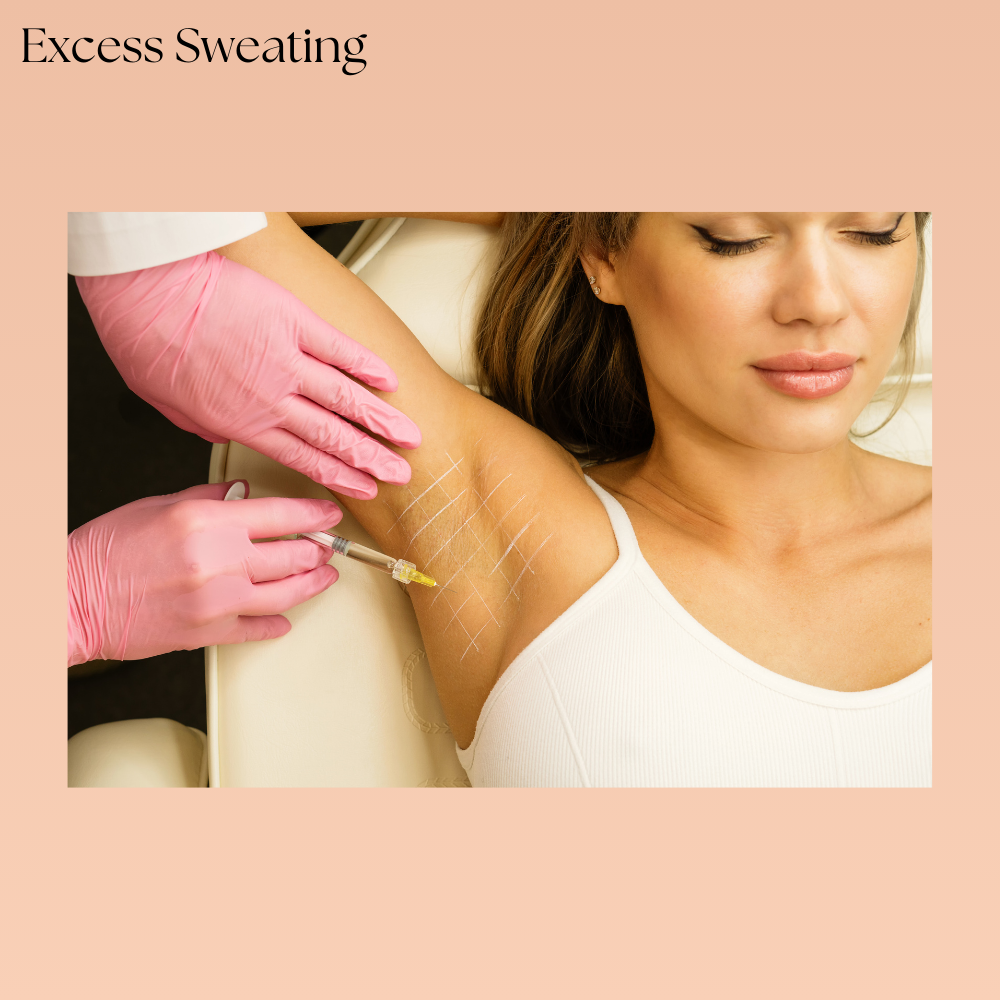 hyperhidrosis-botox-underarm-treatment-areas Medical treatment showing target areas for excessive underarm sweating relief.