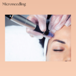 Clinician performing a medical-grade microneedling procedure.