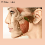 Anatomical diagram highlighting masseter muscle injection zones for TMJ pain relief.